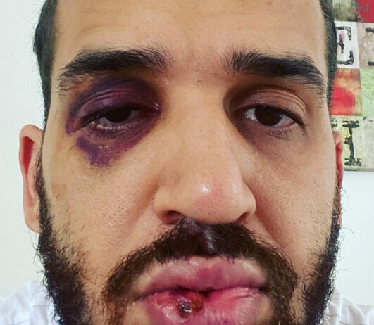 Médico do Paraná é espancado por alertar sobre importância das medidas restritivas