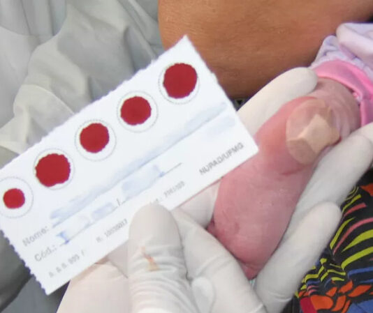 UFMG identifica 68 bebês de mães contaminadas durante gestação nascidos com anticorpos para Covid