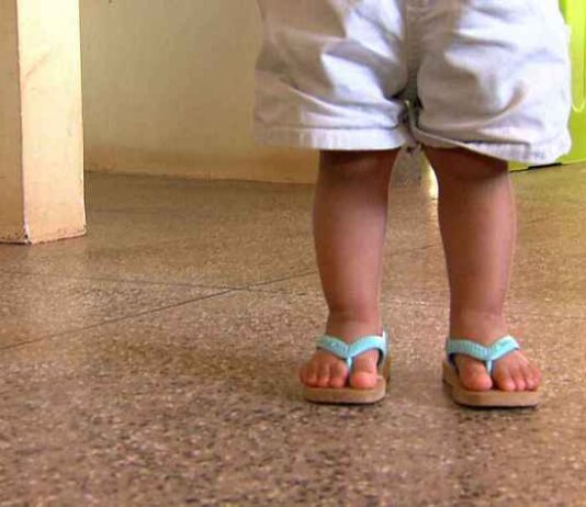 Pesquisa mostra que no Brasil Covid-19 mata sete vezes mais crianças que no Reino Unido