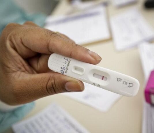 Anvisa libera produção do primeiro autoteste para Covid-19 no Brasil