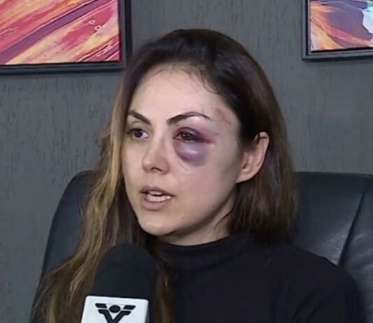 Procuradora espancada por colega em Registro conta detalhes da agressão sofrida