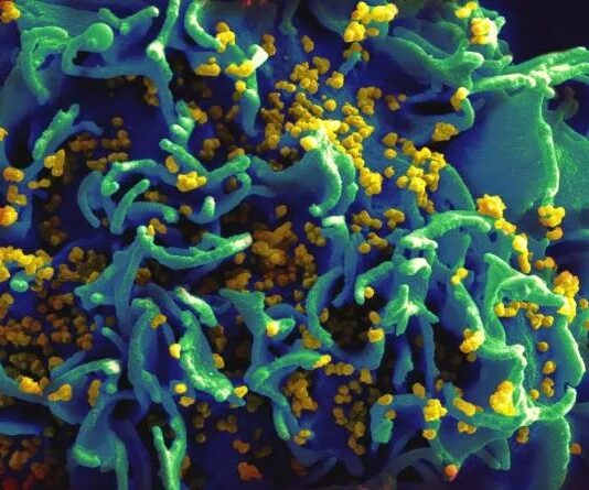 Cura da Aids: médicos dos Estados Unidos anunciam quarto caso no mundo